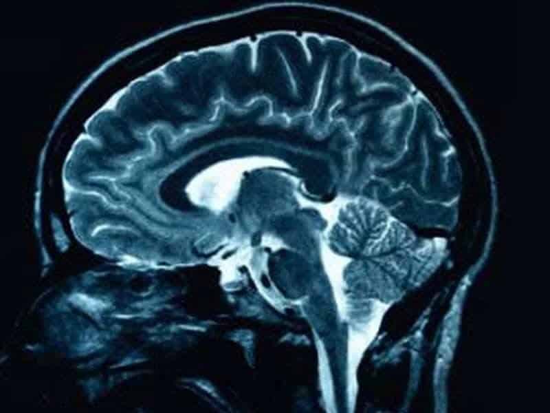 Brain Scan Image