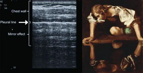 Medical Spectrum Image Mirrored