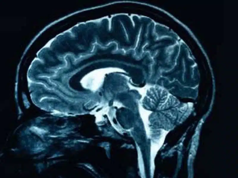 Brain Scan Image