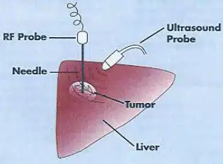 Medical Spectrum Ultrasound Probe Image